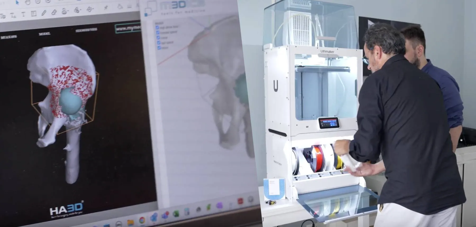 medics-3ditaly-medicale-stampa-3d-stampante-ultimaker-protesi-pre-operatorio-preoperatorio-modelli-chirurgia